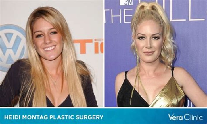 Before the Transformation: Heidi Montag's Journey Pre-Surgery