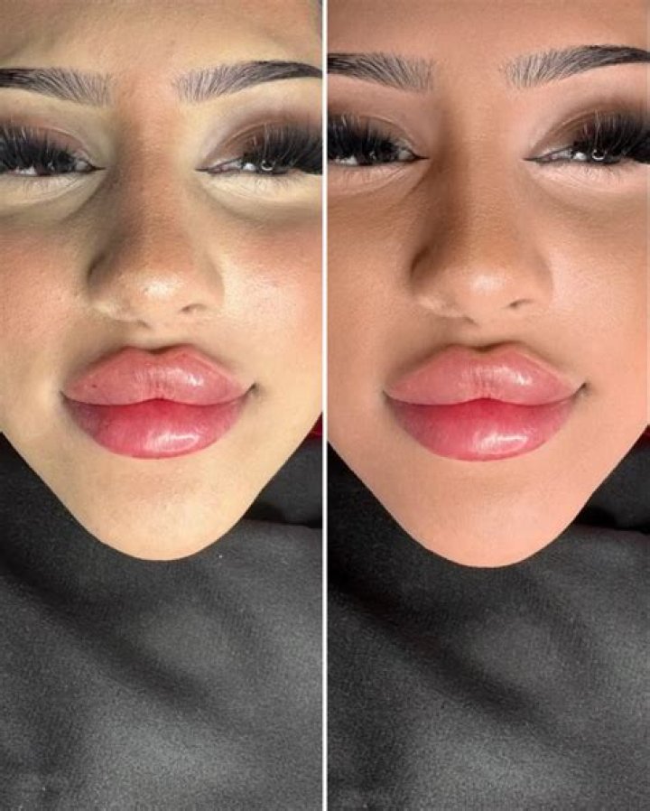 Enhance Ugly Lips: Discover Transformative Solutions