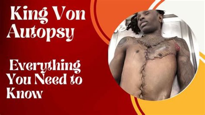 King Von Autopsy: A Comprehensive Analysis and Facts